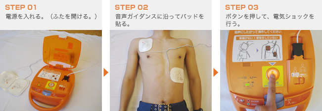 AEDの使用方法